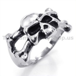 Schedel Titanium Ring